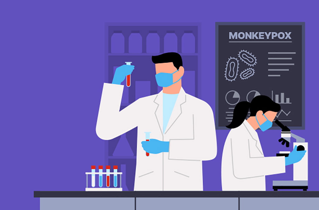 Imagen: La prueba se dirige al virus de la viruela del mono y puede entregar resultados en 90 minutos (Fotografía cortesía de Seegene) Imagen: La prueba se dirige al virus de la viruela del mono y puede entregar resultados en 90 minutos (Fotografía cortesía de Seegene)