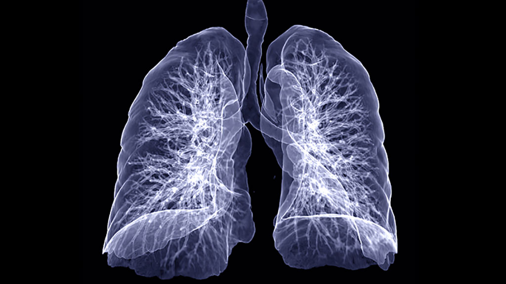 Imagen: Los hallazgos validan el papel de los biomarcadores líquidos en la mejora de la precisión de las edetecciones de cáncer de pulmón (Fotografía cortesía de la Universidad de Missouri-Columbia) Imagen: Los hallazgos validan el papel de los biomarcadores líquidos en la mejora de la precisión de las edetecciones de cáncer de pulmón (Fotografía cortesía de la Universidad de Missouri-Columbia)