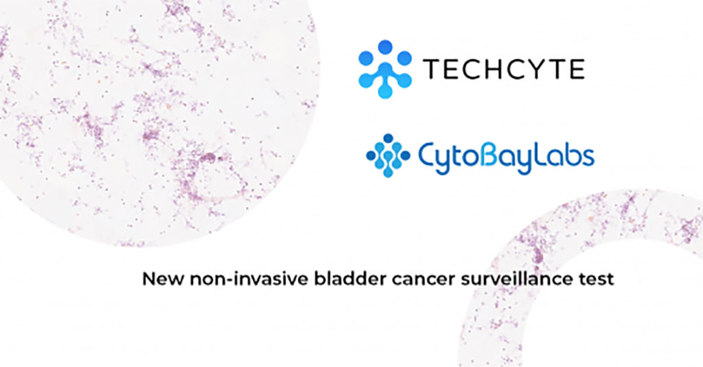 Imagen: Una prueba de diagnóstico digital no invasiva podría proporcionar un diagnóstico preciso de cáncer de vejiga (Fotografía cortesía de Techcyte)