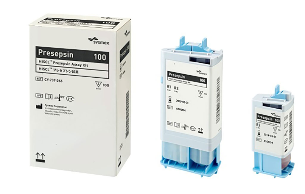 Imagen: El kit de ensayo de presepsina HISCL se puede utilizar con su sistema de inmunoensayo automatizado HISCL-5000/2000i/800 para pruebas inmunoquímicas (Fotografía cortesía de Sysmex Corporation)