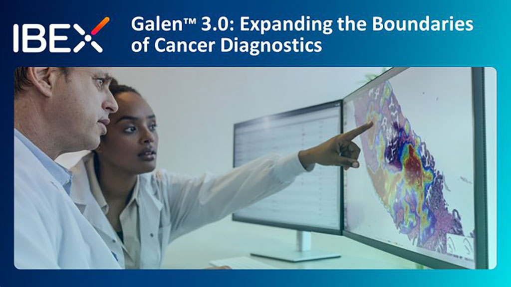 Imagen: Galen es la plataforma de patología impulsada por IA más ampliamente implementada (Fotografía cortesía de Ibex)