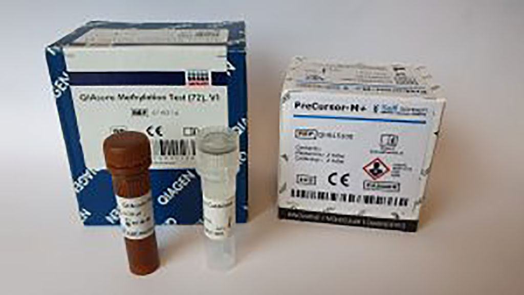 Imagen: La prueba de metilación Precursor-M+/QIAsure (Fotografía cortesía de Self-screen B.V.) Imagen: La prueba de metilación Precursor-M+/QIAsure (Fotografía cortesía de Self-screen B.V.)