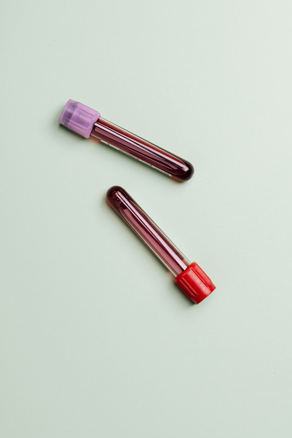 Imagen: Un análisis de sangre para mujeres embarazadas usa IA para diagnosticar defectos cardíacos congénitos (Fotografía cortesía de Pexels) Imagen: Un análisis de sangre para mujeres embarazadas usa IA para diagnosticar defectos cardíacos congénitos (Fotografía cortesía de Pexels)