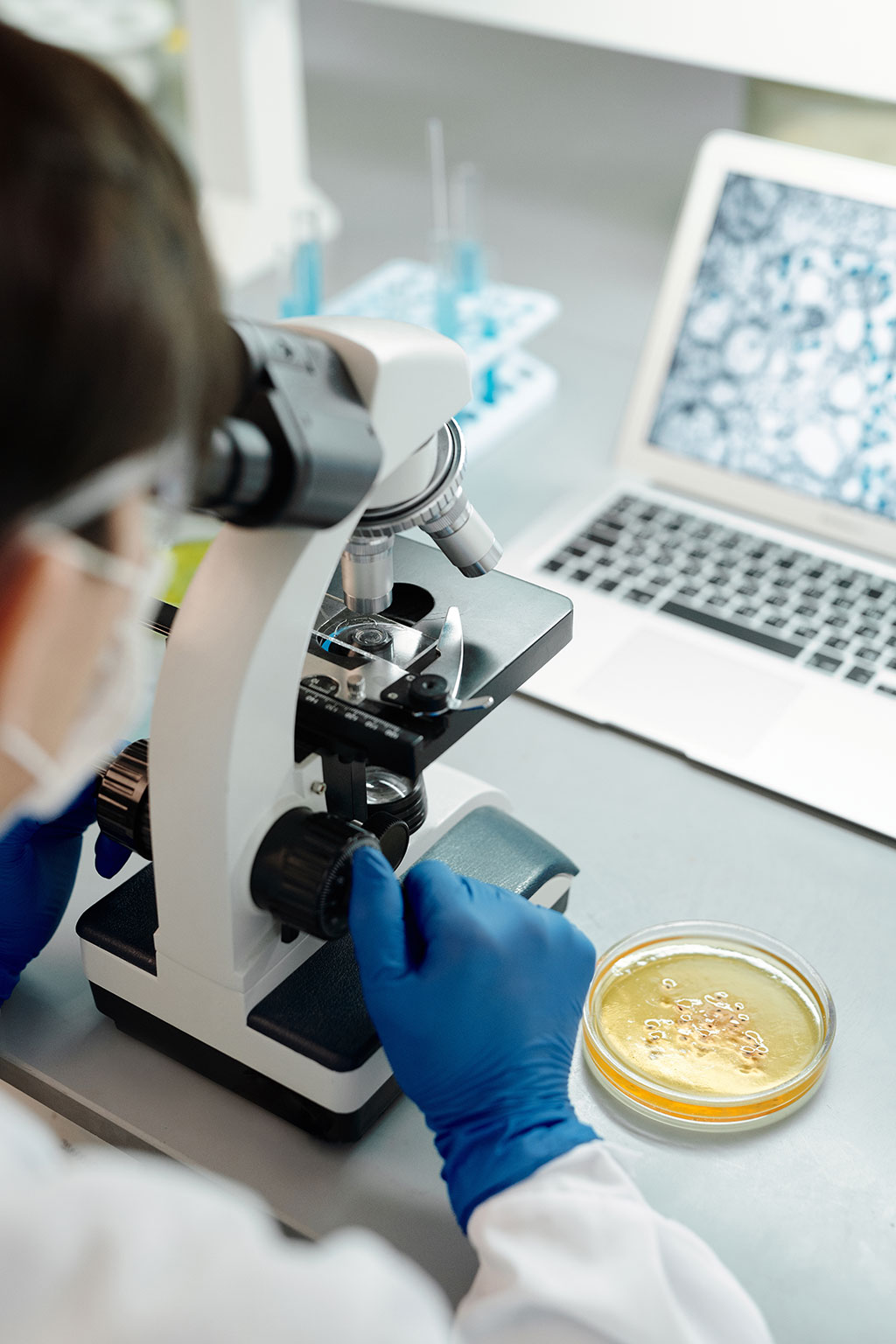 Imagen: Detección de neoplasias malignas mieloides a través del perfil de cfADN en pacientes con cáncer de estadio avanzado (Fotografía cortesía de Pexels) Imagen: Detección de neoplasias malignas mieloides a través del perfil de cfADN en pacientes con cáncer de estadio avanzado (Fotografía cortesía de Pexels)