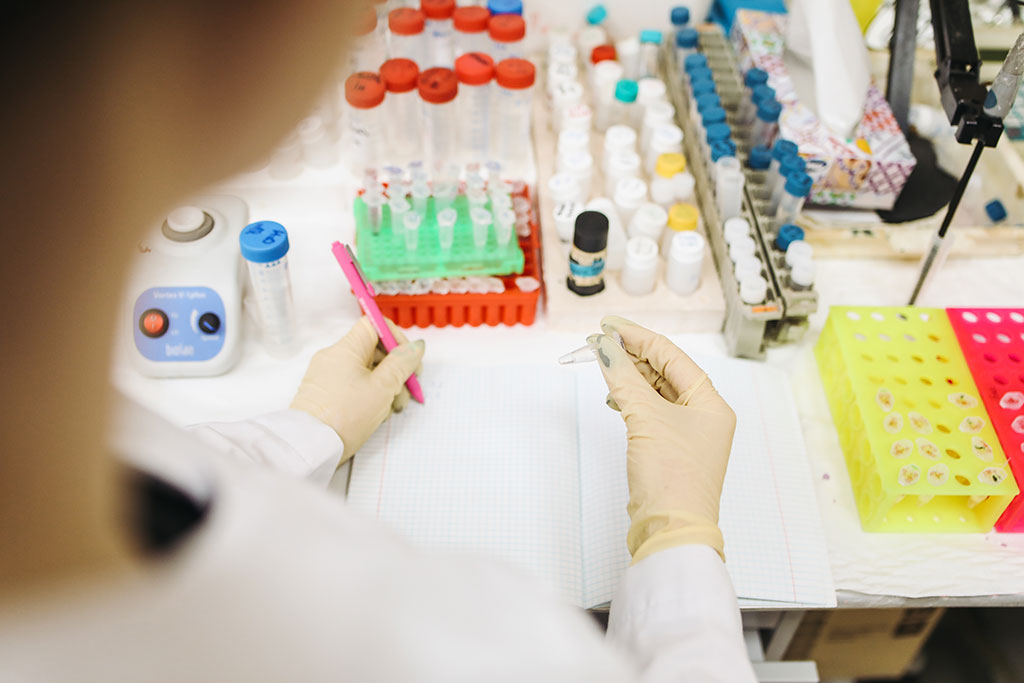 Imagen: La nueva prueba para el síndrome antifosfolípidico, una enfermedad autoinmune, es cien veces de más afinada (Fotografía cortesía de Pexels) Imagen: La nueva prueba para el síndrome antifosfolípidico, una enfermedad autoinmune, es cien veces de más afinada (Fotografía cortesía de Pexels)