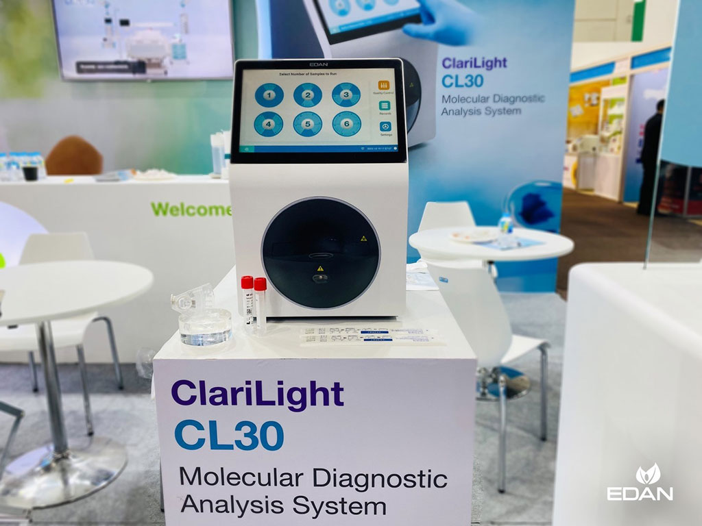 Imagen: Sistema de análisis de diagnóstico molecular ClariLight CL30 (Fotografía cortesía de EDAN)