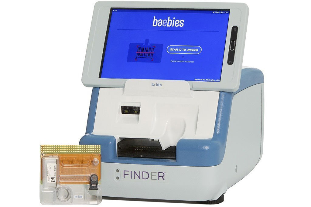 Imagen: Plataforma de prueba FINDER para G6PD alimentada por tecnología de microfluidos digitales (Fotografía cortesía de Baebies)