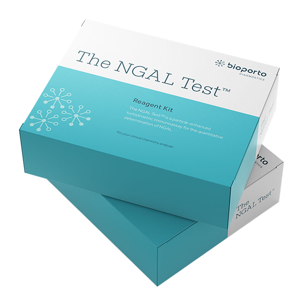 Imagen: La prueba NGAL es una herramienta para la evaluación de riesgo del daño renal (Fotografía cortesía de BioPorto)
