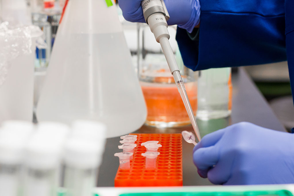 Imagen: Los investigadores han descubierto potencial de diagnóstico en la secuenciación de ARN de células de fluidos amnióticos en descifrar enfermedades raras (Fotografía cortesía de Pexels) Imagen: Los investigadores han descubierto potencial de diagnóstico en la secuenciación de ARN de células de fluidos amnióticos en descifrar enfermedades raras (Fotografía cortesía de Pexels)