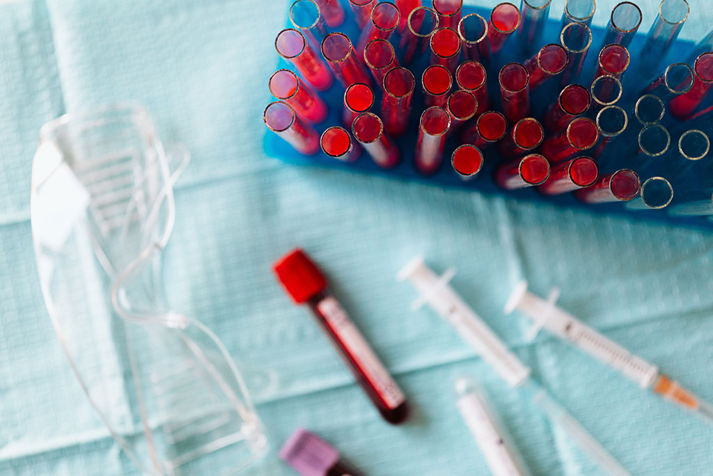 Imagen: Los ácidos grasos de cadena corta en la sangre pueden servir como biomarcadores en las pruebas de complicaciones del embarazo (Fotografía cortesía de Pexels) Imagen: Los ácidos grasos de cadena corta en la sangre pueden servir como biomarcadores en las pruebas de complicaciones del embarazo (Fotografía cortesía de Pexels)