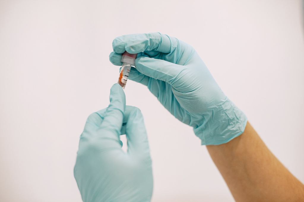 Fragmentos de ADN en la sangre prometen una prueba barata y fácil para el cáncer (Fotografía cortesía de Pexels) Fragmentos de ADN en la sangre prometen una prueba barata y fácil para el cáncer (Fotografía cortesía de Pexels)