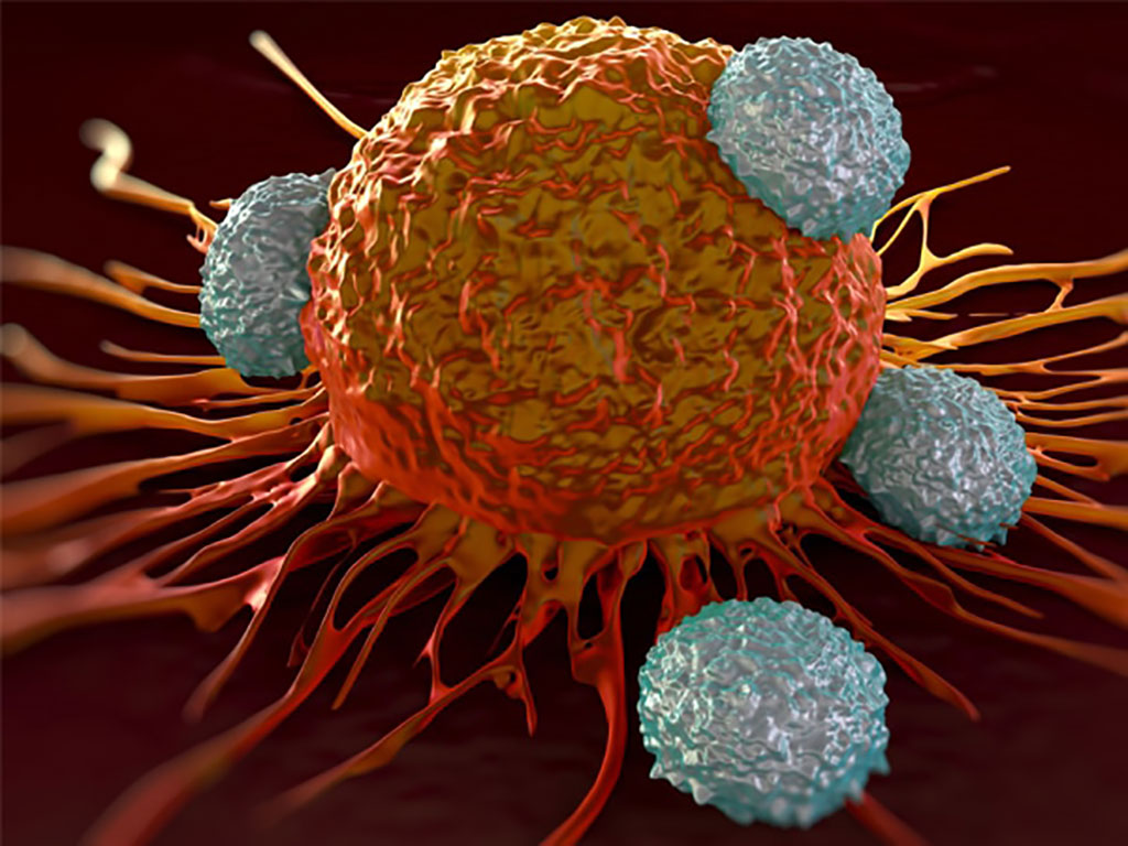 Imagen: Los investigadores han desarrollado una nueva prueba basada en orina para la detección no invasiva del cáncer de vejiga (Fotografía cortesía de Nonacus)