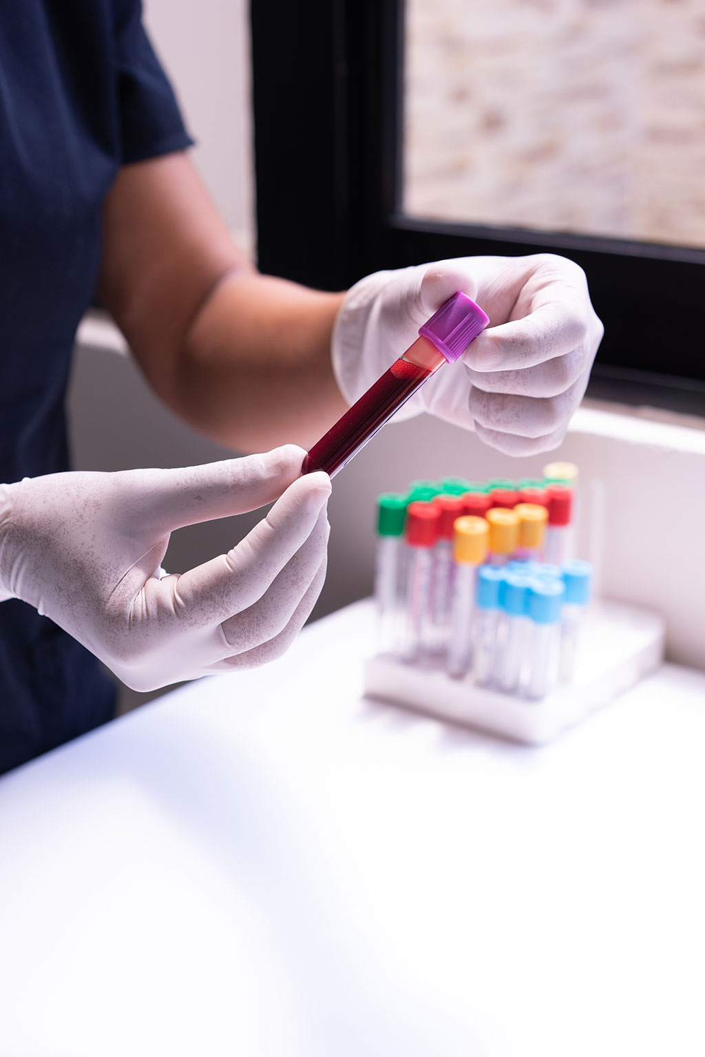 Imagen: Una nueva investigación realizada por los neurocientíficos sentará las bases para la medicina de precisión de la enfermedad (Fotografía cortesía de Pexels) Imagen: Una nueva investigación realizada por los neurocientíficos sentará las bases para la medicina de precisión de la enfermedad (Fotografía cortesía de Pexels)