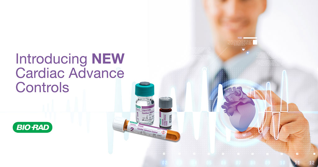 Imagen: Los nuevos controles Cardiac Advance están optimizados con objetivos de troponina cerca del límite de detección del instrumento (Fotografía cortesía de Bio-Rad) Imagen: Los nuevos controles Cardiac Advance están optimizados con objetivos de troponina cerca del límite de detección del instrumento (Fotografía cortesía de Bio-Rad)