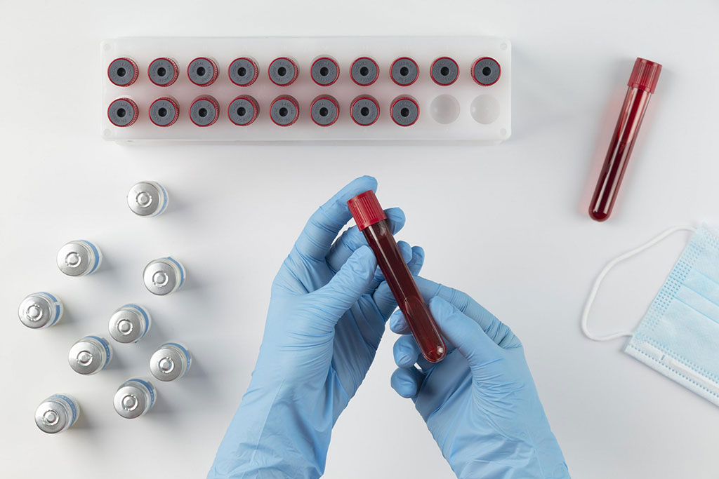 Imagen: La prueba de cáncer de seno Syantra DX obtuvo la marca CE (Fotografía cortesía de Freepik) Imagen: La prueba de cáncer de seno Syantra DX obtuvo la marca CE (Fotografía cortesía de Freepik)