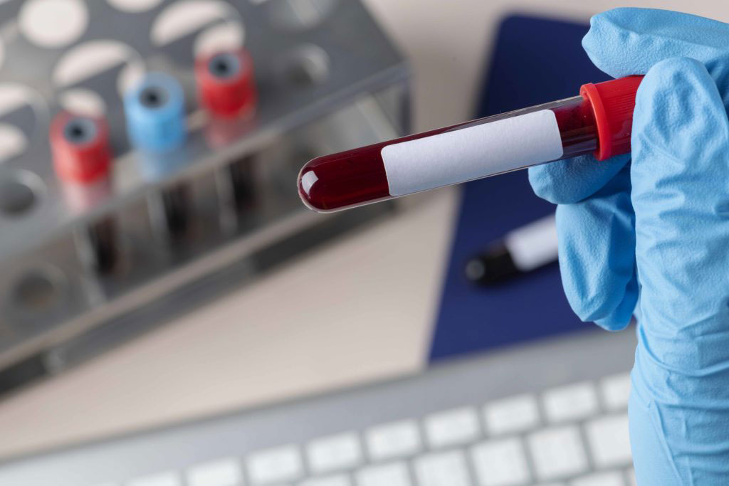 Imagen: La prueba Avantect ha mostrado un sólido desempeño para la detección temprana del cáncer de páncreas con epigenómica (Fotografía cortesía de Freepik) Imagen: La prueba Avantect ha mostrado un sólido desempeño para la detección temprana del cáncer de páncreas con epigenómica (Fotografía cortesía de Freepik)