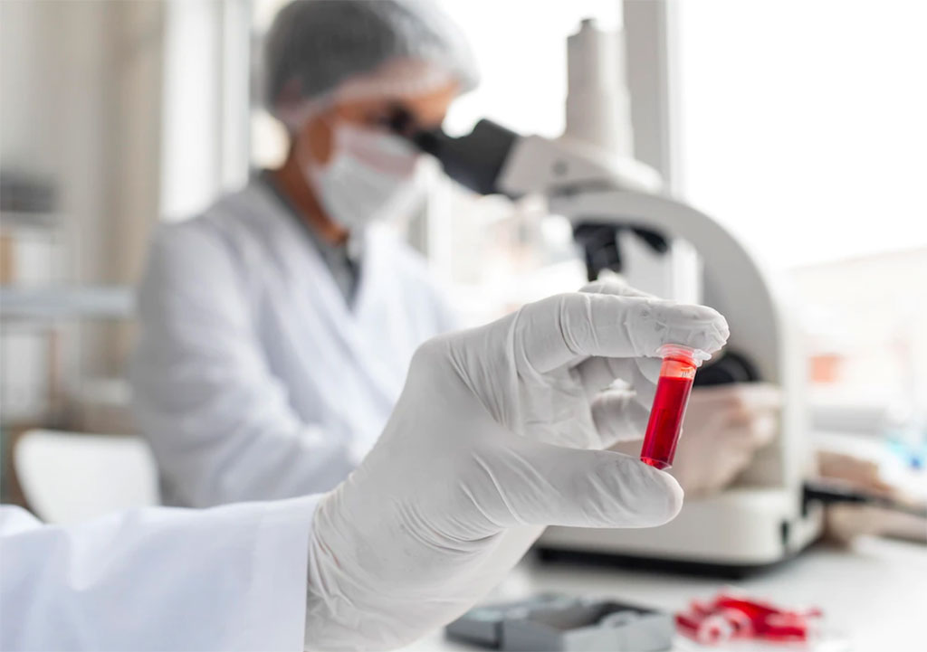 Imagen: LucenceINSIGHT permite la detección temprana del cáncer a través de un solo análisis de sangre (Fotografía cortesía de Freepix) Imagen: LucenceINSIGHT permite la detección temprana del cáncer a través de un solo análisis de sangre (Fotografía cortesía de Freepix)