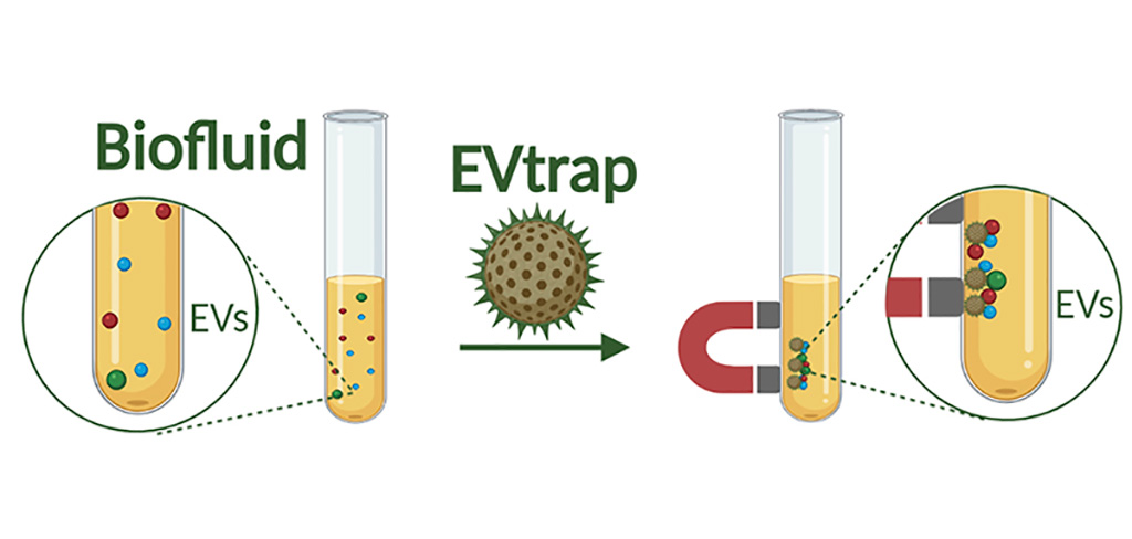 Imagen: La tecnología EVtrap utiliza cuentas magnéticas para aislar e identificar rápidamente grandes cantidades de proteínas de vesículas extracelulares (Fotografía cortesía de la Universidad de Purdue)
