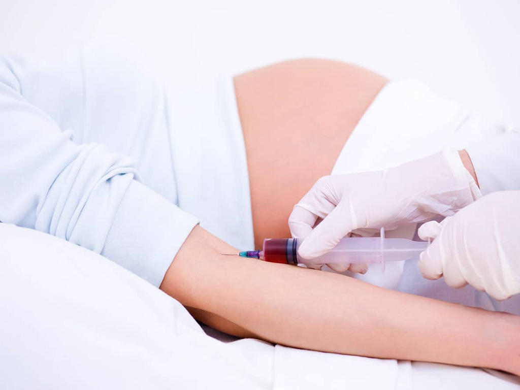 Residuos Color rosa Reorganizar Análisis de sangre realizado después de un aborto espontáneo puede predecir  riesgo futuro de pérdida del embarazo - diagnostico-molecular -  mobile.Labmedica.es