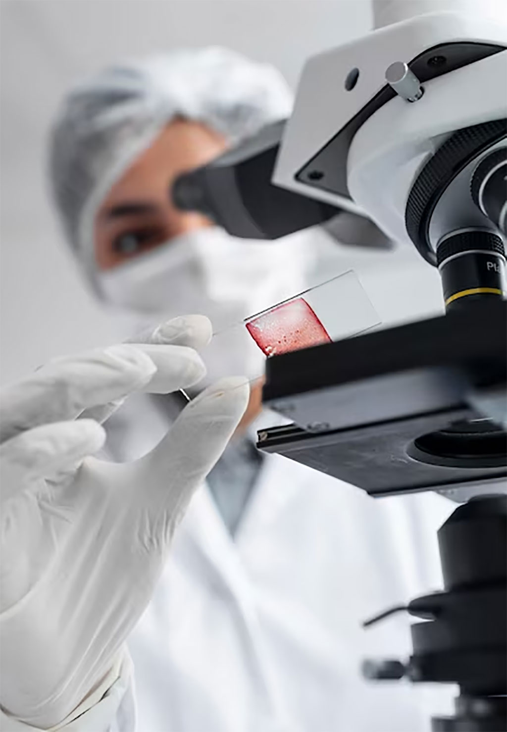 Imagen: El análisis de sangre de diagnóstico para el cáncer de mama permitirá la detección temprana (Fotografía cortesía de Freepik) Imagen: El análisis de sangre de diagnóstico para el cáncer de mama permitirá la detección temprana (Fotografía cortesía de Freepik)