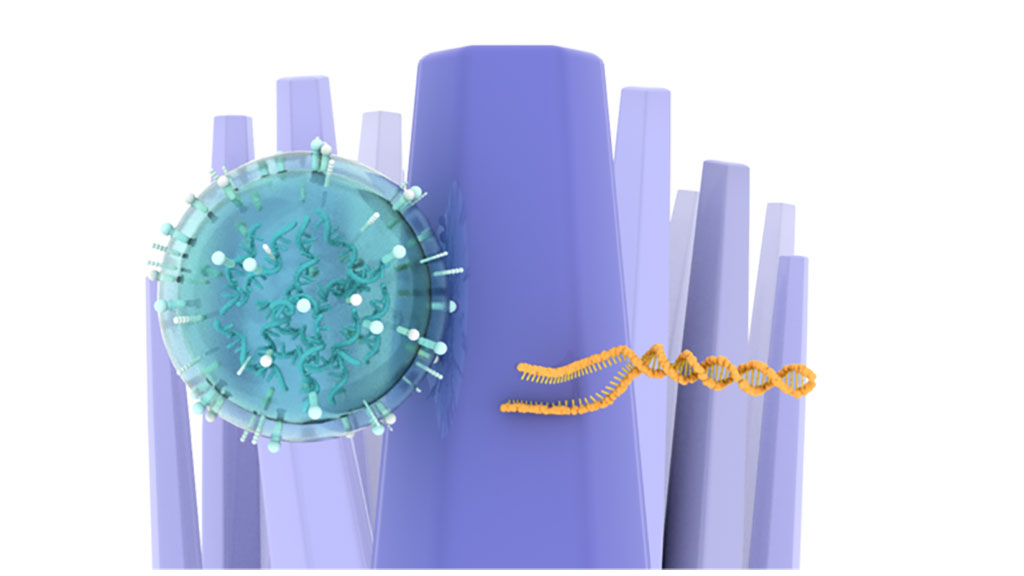 Imagen: Las pruebas de orina identifican tumores cerebrales capturando VE derivadas del cáncer y ADN usando nanocables (Fotografía cortesía de la Universidad de Nagoya)