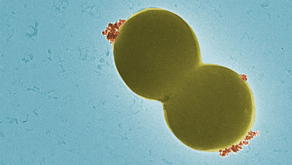 Imagen: Las nanopartículas magnéticas (rojo) se unen específicamente a las bacterias esféricas (amarillo) (Fotografía cortesía de Empa)