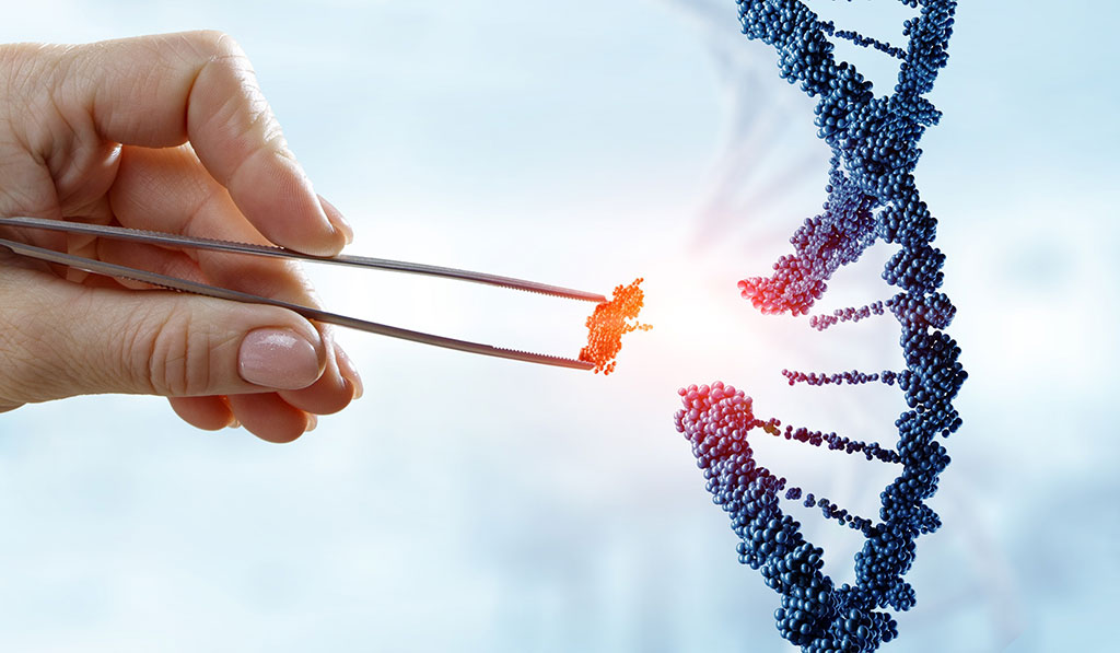 Imagen: Una prueba de diagnóstico basada en la tecnología CRISPR detecta MPXV en muestras clínicas con precisión aguda (Fotografía cortesía de 123RF)