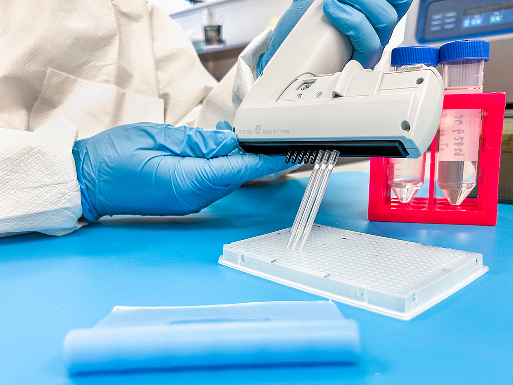 Imagen: La prueba de respuesta al tratamiento del cáncer neuroendocrino PPQ ofrece una precisión del 96 % (Fotografía cortesía de Wren Laboratories) Imagen: La prueba de respuesta al tratamiento del cáncer neuroendocrino PPQ ofrece una precisión del 96 % (Fotografía cortesía de Wren Laboratories)