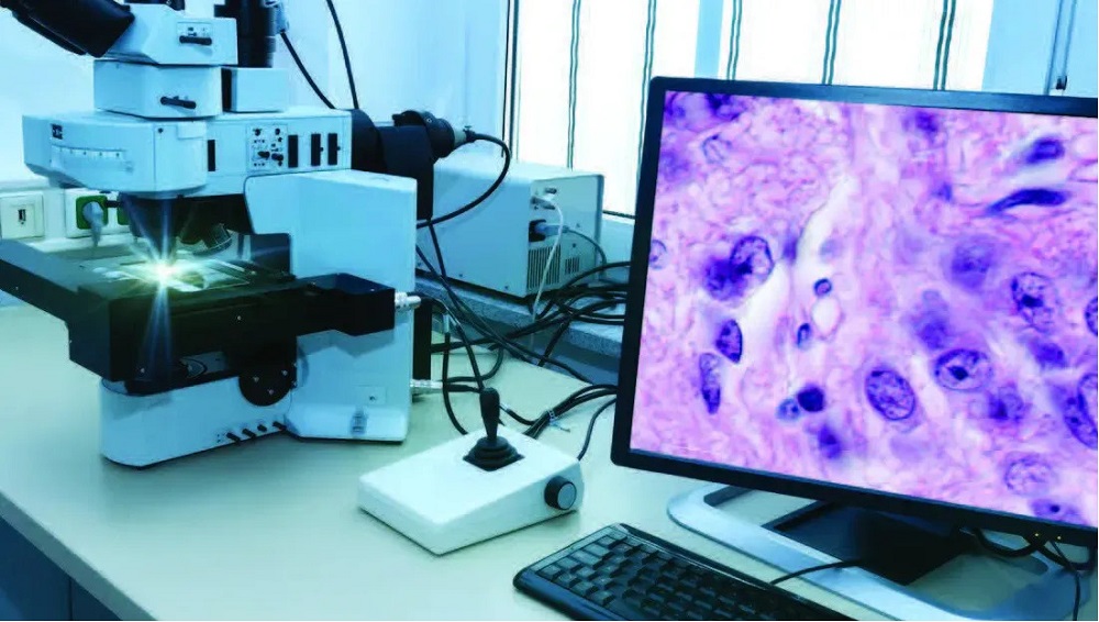 Imagen: El algoritmo Mitotic Counting fue entrenado en más de 100.000 mitosis individual y en siete modelos de escáner (Fotografía cortesía de Gestalt Diagnostics)