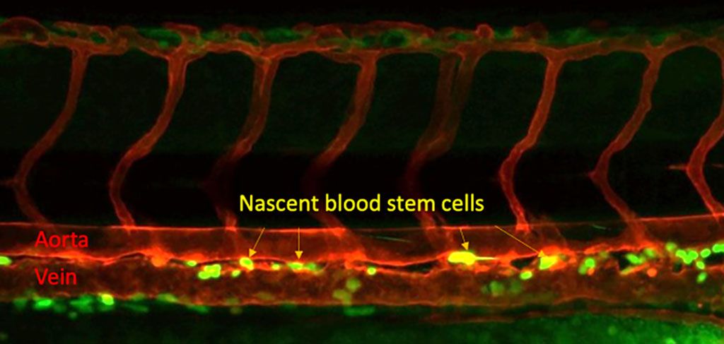 Imagen: Células madre sanguíneas que se forman en el tronco de un embrión de pez cebra (Fotografía cortesía de Xiaoyi Cheng)