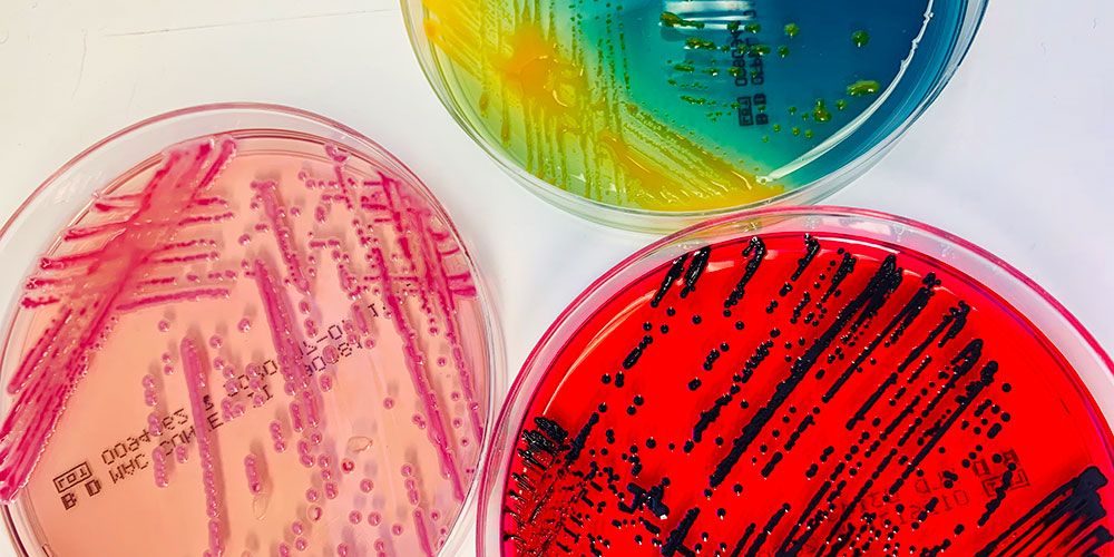 Imagen: La identificación confiable de los gérmenes cultivados es esencial en la bacteriología clínica (Fotografía cortesía del Hospital Universitario Basilea)