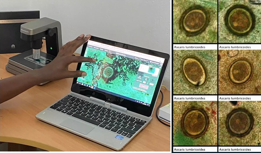 Imagen: la IA jugó un papel crítico en la detección de infecciones de gusanos intestinales entre niños en Kenia (foto cortesía de la Universidad de Helsinki)