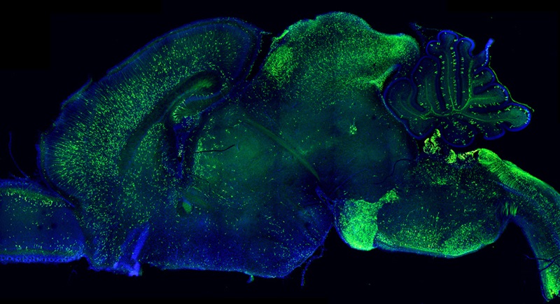 Imagen: Una imagen del cerebro con expresión de perturbación (foto cortesía de Scripps Research)
