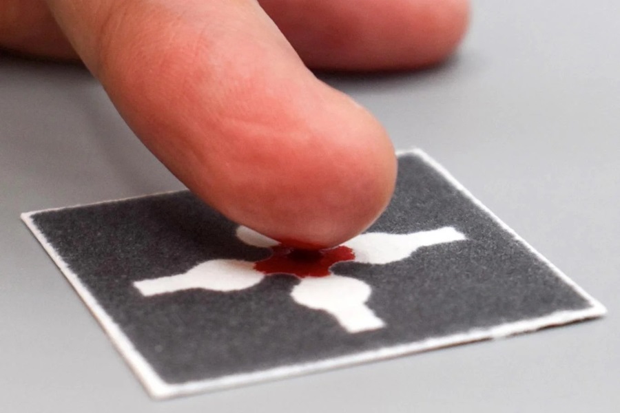 Imagen: Los usuarios extraen sangre con un pinchazo en el dedo en casa y envían la tarjeta a un laboratorio para recuentos de glóbulos blancos (foto cortesía de Charlie Mace)