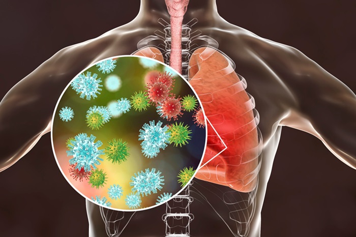Imagen: La nueva guía de ADLM ayudará a los profesionales de la salud a gestionar las pruebas de virus respiratorios en un mundo post-COVID (foto cortesía de 123RF)