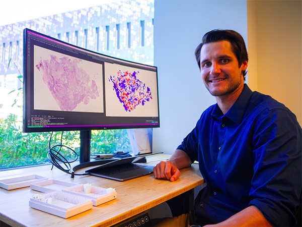 Imagen: La nueva herramienta AI puede detectar alteraciones genómicas clínicamente procesables directamente de los diapositivas de biopsia (Foto cortesía de la Escuela de Ingeniería Jacobs de la UC San Diego)