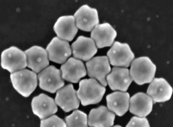 Imagen: una imagen de microscopio electrónico de barrido de nanopartículas de oro quiral desarrolladas para un nuevo chip microfluídico (Matter, 2024; DOI: 10.1016/j.matt.2024.09.005)