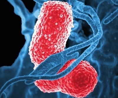 Imagen: las pruebas rápidas de PCR en la UCI no pudieron demostrar no inferioridad en la cura clínica de la neumonía (foto cortesía de Shutterstock)