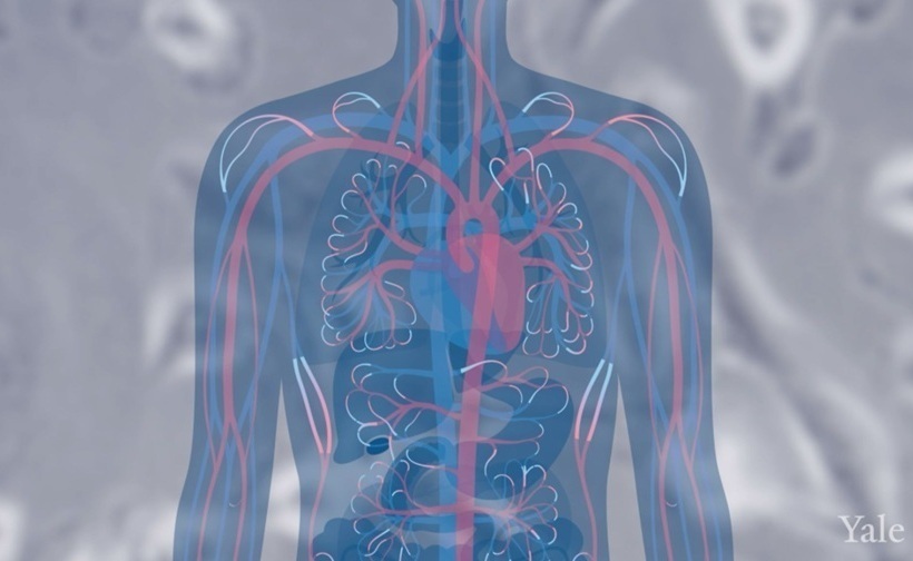 Imagen: los hallazgos se basaron en pacientes del ensayo clínico de ADAURA de la terapia dirigida osimertinib para pacientes con CPCNP con mutaciones activadas por EGFR (foto cortesía del equipo multimedia de YSM)