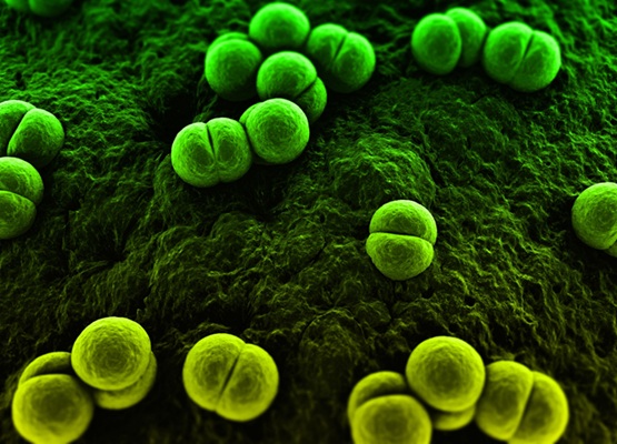 Imagen: se encontró que la proteína PCR en el líquido cefalorraquídeo era un indicador muy confiable de la meningitis bacteriana (foto cortesía de 123RF) Imagen: se encontró que la proteína PCR en el líquido cefalorraquídeo era un indicador muy confiable de la meningitis bacteriana (foto cortesía de 123RF)