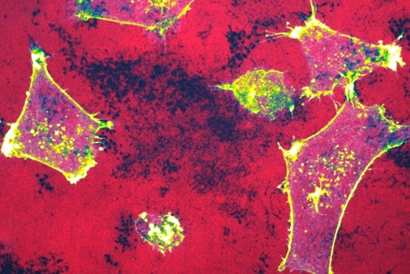 Imagen: Imagen de microscopía de células de cáncer de mama invasivas degradando su matriz extracelular subyacente (foto cortesía de la Universidad de Turku) Imagen: Imagen de microscopía de células de cáncer de mama invasivas degradando su matriz extracelular subyacente (foto cortesía de la Universidad de Turku)