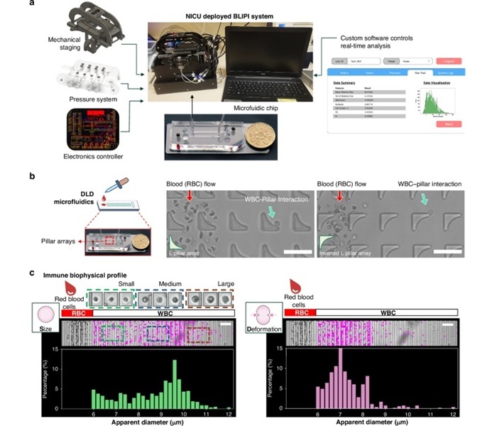 Imagen: hardware y software personalizados para la detección en tiempo real de firmas biofísicas de células inmunes en la UCIN (foto cortesía de Pediatric Research, DOI: 10.1038/s41390-025-03952-y) Imagen: hardware y software personalizados para la detección en tiempo real de firmas biofísicas de células inmunes en la UCIN (foto cortesía de Pediatric Research, DOI: 10.1038/s41390-025-03952-y)