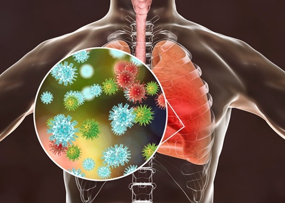 Imagen: una firma mínima de respuesta del huésped de cuatro genes detectada en la sangre puede excluir infecciones respiratorias bacterianas (fotografía cortesía de 123RF) Imagen: una firma mínima de respuesta del huésped de cuatro genes detectada en la sangre puede excluir infecciones respiratorias bacterianas (fotografía cortesía de 123RF)