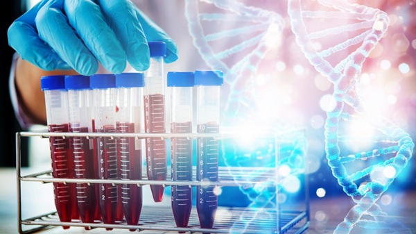 Imagen: los patrones de expresión genética en muestras de sangre analizadas con aprendizaje automático podrían ayudar a detectar la ELA con anterioridad (fotografía cortesía de Shutterstock)