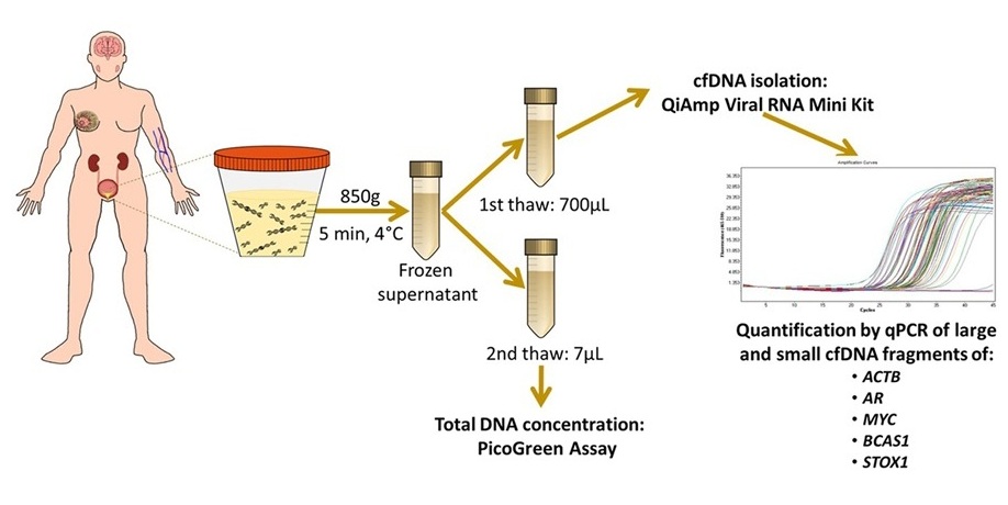 Imagen: el análisis de patrones específicos de fragmentación del ADNlc en muestras de orina puede diagnosticar y estadificar el cáncer de vejiga (Herranz et al., The Journal of Molecular Diagnostics, DOI: 10.1016/j.jmoldx.2025.08.010)