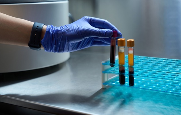 Imagen: un solo análisis de sangre ayudará a obtener una descripción general de todo el historial de infecciones y el estado inmunológico de un individuo (fotografía cortesía de 123RF)