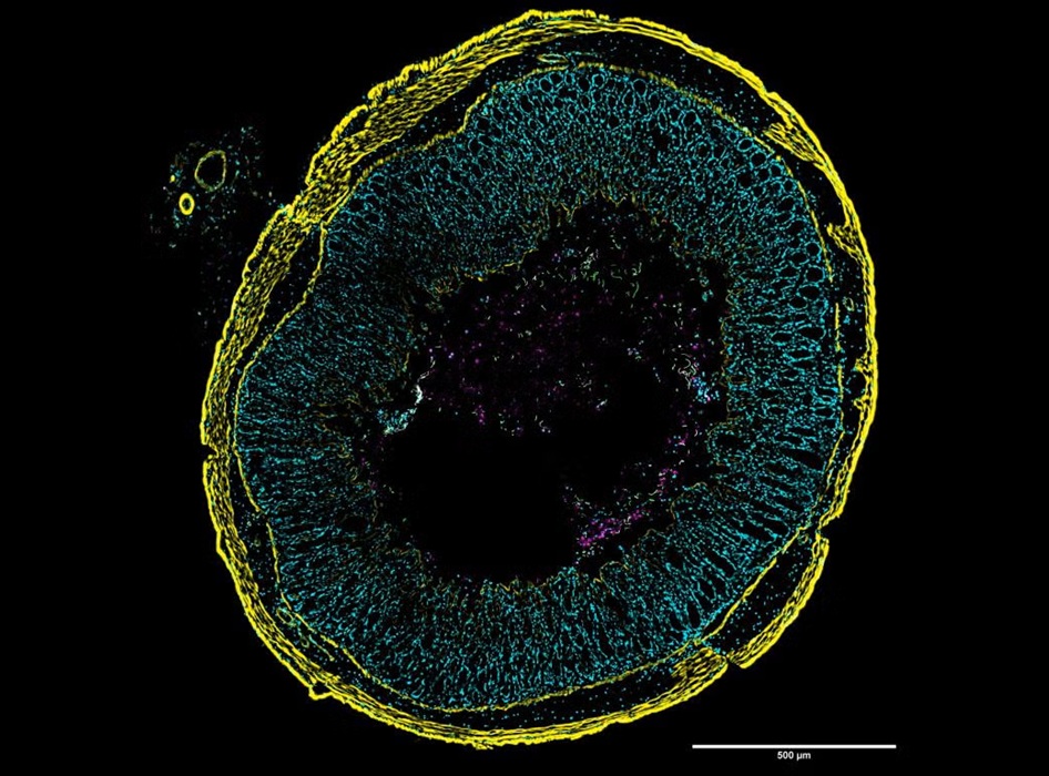 Imagen: el nuevo enfoque de imágenes utiliza etiquetas microscópicas brillantes para revelar la actividad genética en células individuales de C. diff (Fotografía cortesía de Nicholas DiBenedetto)