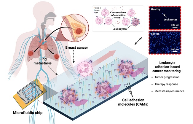 Imagen: Descripción general del ensayo microfluídico para el perfilado de la adhesión de leucocitos asociados al cáncer (Fotografía cortesía de Brian Choi, Seyong Kwon, Min Seok Lee, et al.) Imagen: Descripción general del ensayo microfluídico para el perfilado de la adhesión de leucocitos asociados al cáncer (Fotografía cortesía de Brian Choi, Seyong Kwon, Min Seok Lee, et al.)