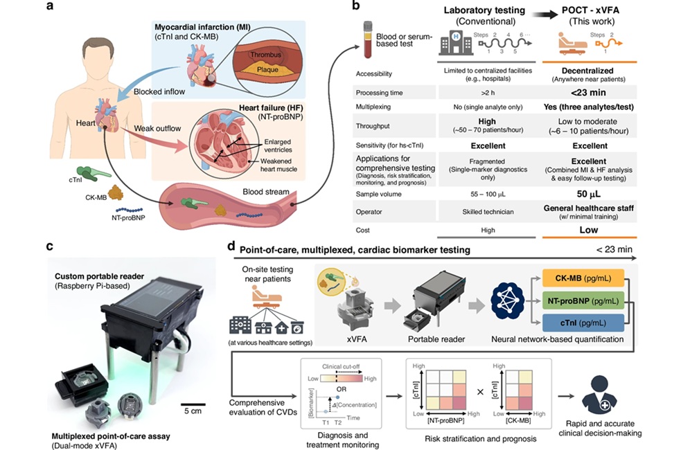 Imagen: Descripción general de la plataforma de sensor óptico xVFA de doble modo para la detección multiplexada de biomarcadores cardíacos en entornos de punto de atención (Han, GR., Eryilmaz, M., Goncharov, A. et al. Light Sci Appl 15, 190 (2026). doi.org/10.1038/s41377-026-02275-9)