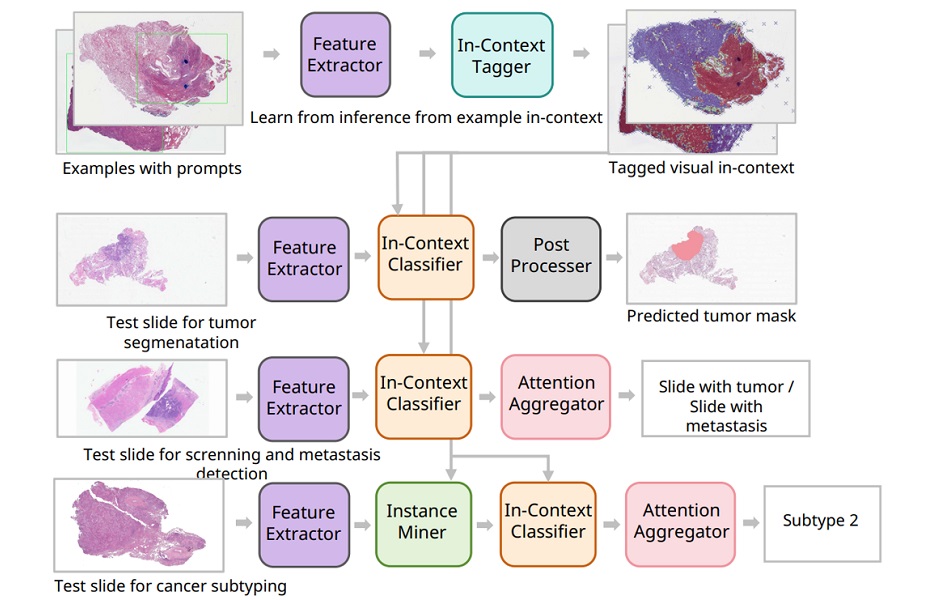 Imagen: El sistema PRET proporciona una solución integrada para múltiples tareas de diagnóstico de patología, incluida la detección de cáncer, la subtipificación de tumores, la segmentación de tumores y la detección de metástasis en los ganglios linfáticos  (Li, Y., Ning, Z., Xiang, T. et al. Nature Cancer (2026). doi.org/10.1038/s43018-026-01141-2)